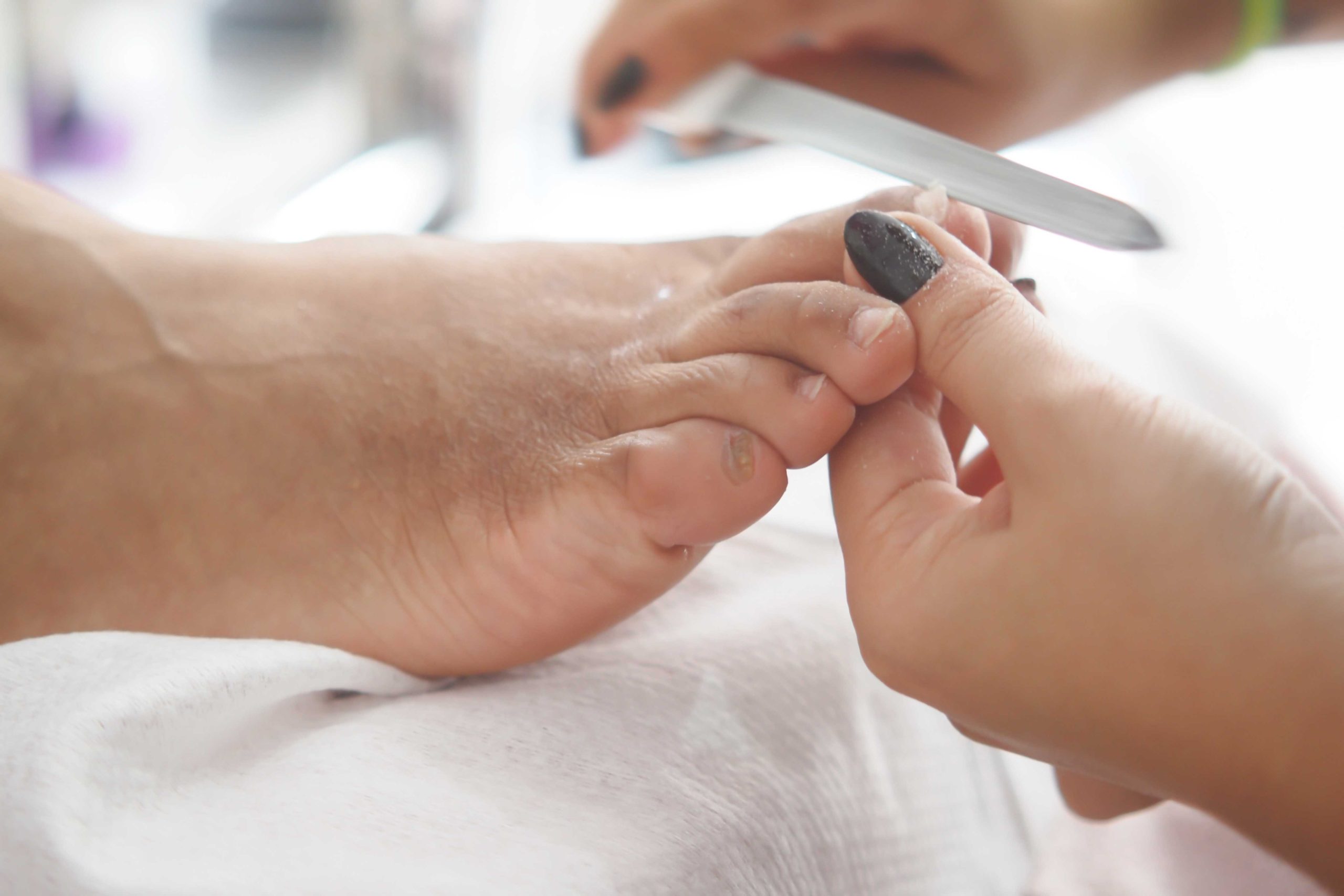 Pedicure vijlt teennagels tijdens professionele voetverzorging bij medisch pedicure